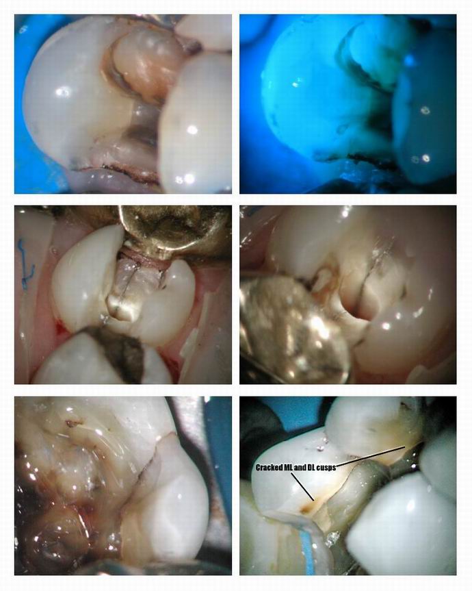 Resize of Cracked teeth pg 4.jpg